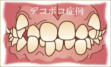 歯のデコボコ矯正治療解説