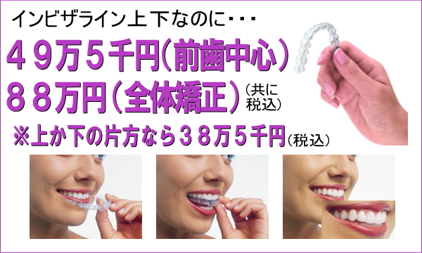 インビザライン上下なのに
