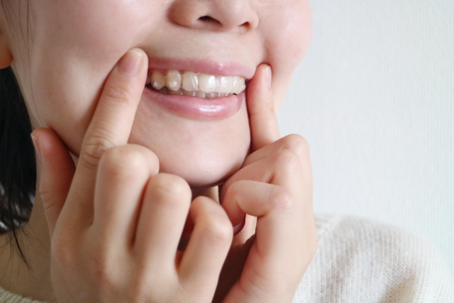 歯列矯正の特徴