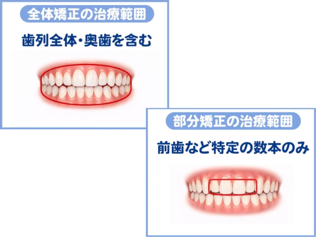 治療範囲の選択：全体矯正 vs 部分矯正