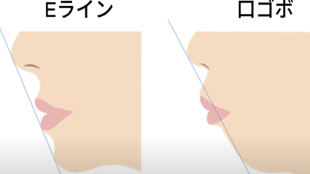 横顔の劇的な改善は期待できない