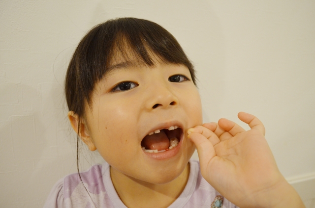 永久歯欠損を歯列矯正で治療するメリットをご紹介｜先天的な永久歯欠損の特徴も詳しく解説します