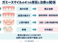 ガミースマイルの4つの原因と治療の関係