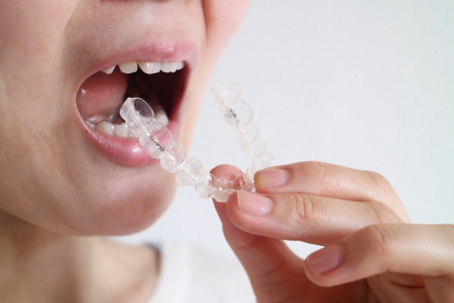 歯列矯正を短期間で終わらせることはできる？矯正期間を短縮させる方法や抜歯の必要性を歯科医が解説