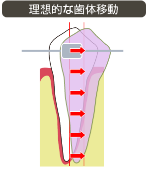理想的な歯体移動
