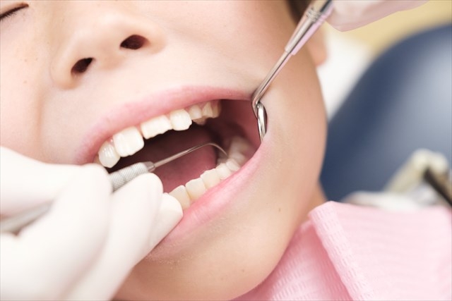 子供の過剰歯は早めに治療することが大切