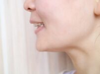 拡大床の種類と正しい使い方｜矯正歯科医が解説する拡大床のメリット・デメリット