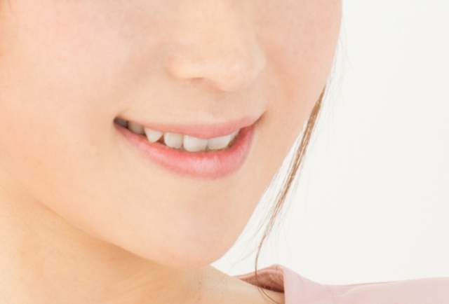 八重歯の抜歯矯正のメリット