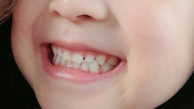 歯の本数