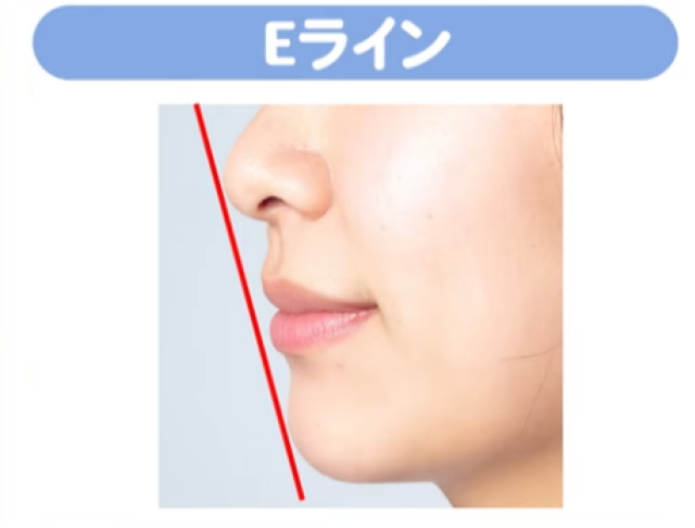 Eライン（横顔の美しさの基準）を大きく改善したい場合