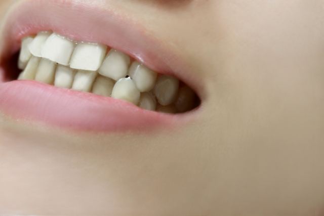 前歯だけ治したいときの選択肢は？