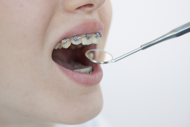 歯茎を引っ込める方法