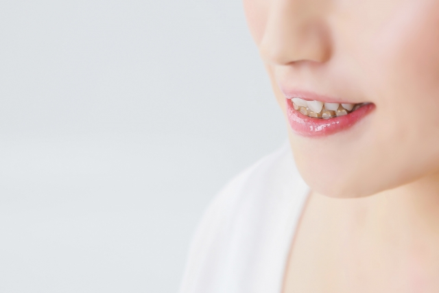 大人乳歯の特徴