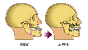 外科矯正のスケジュール