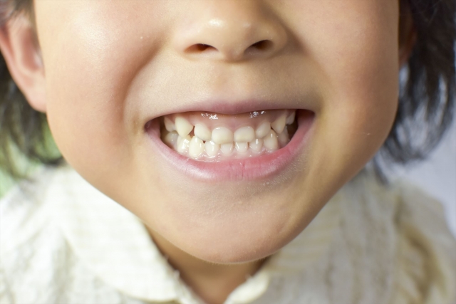 乳歯に隙間がないと永久歯に影響する？乳歯の歯並びの特徴や生え変わり期の注意点を歯科医が解説