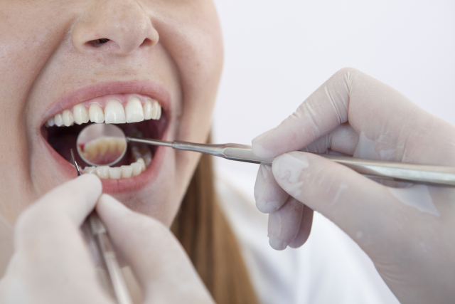インビザライン矯正では歯を削ることがある？