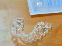 観点③矯正料金は適正か