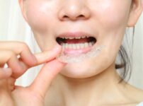 歯列矯正でブラックトライアングルができる理由