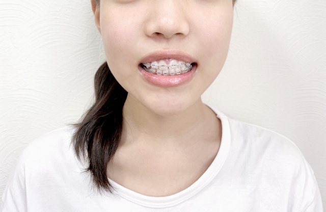 非抜歯をかかげる矯正歯科は増えている