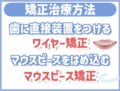 矯正治療方法 ワイヤー矯正 マウスピース矯正